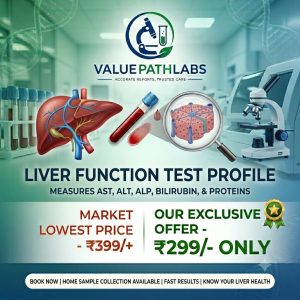 Liver Function Test (LFT)