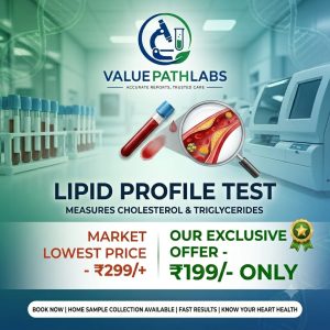 Lipid Profile Test